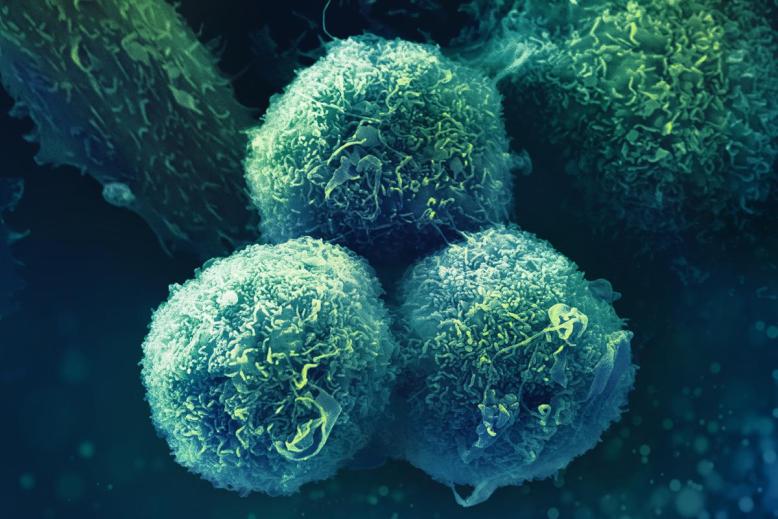 computer rendering of cancerous tissue at micro scale