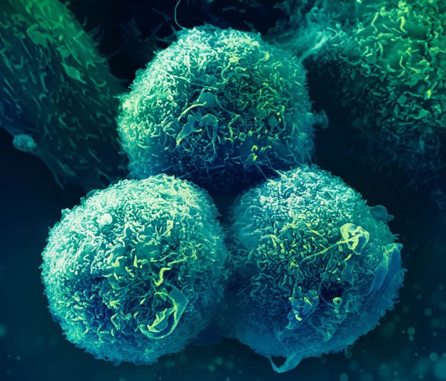 Computer rendering of cancerous tissue at micro scale