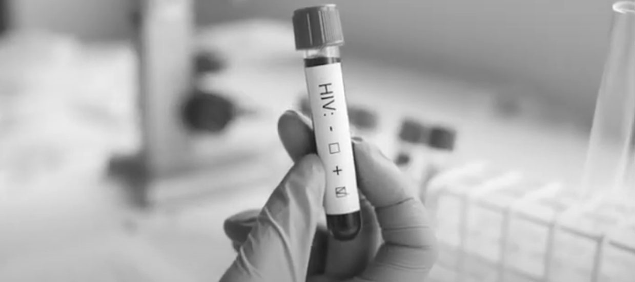 hiv vial
