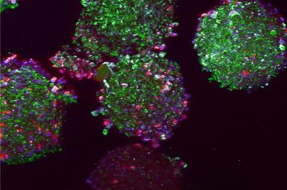 Neural micro-spheroids