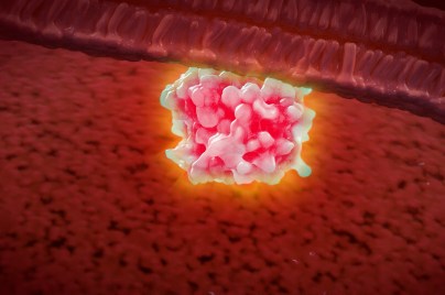 3D depiction of KRAS protein complex