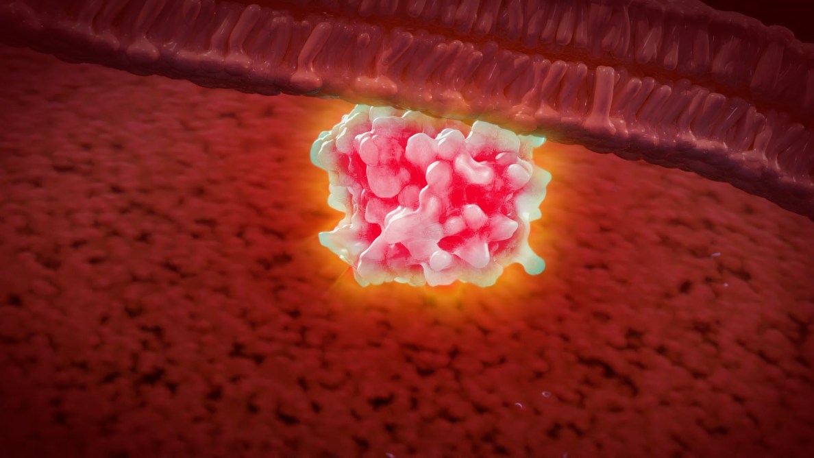 3D depiction of KRAS protein complex