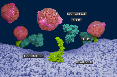 Image for Understanding the health risks of high LDL cholesterol