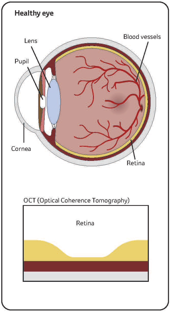 Illustration of healthy eye