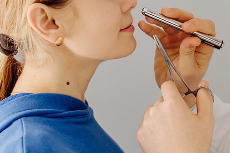 Cánceres de cavidad nasal y senos paranasales