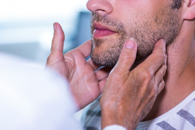 Cáncer de las glándulas salivales